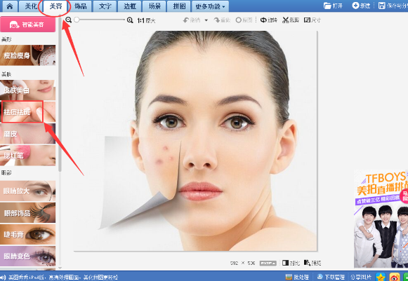美圖秀秀怎么去除痘痘疤痕?美圖秀秀去除痘痘疤痕圖文教程