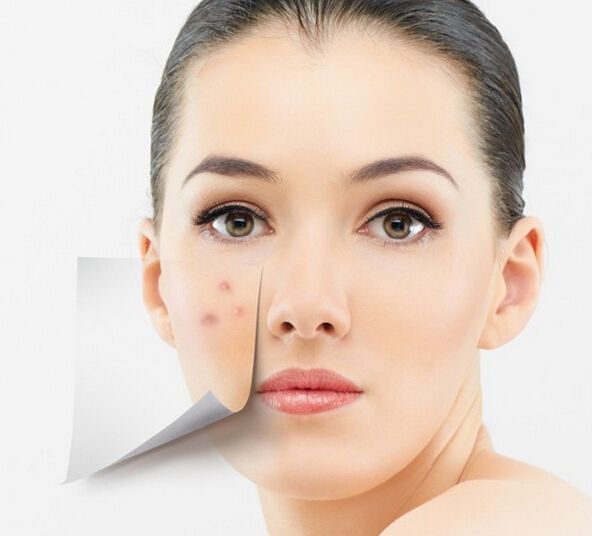 美圖秀秀怎么去除痘痘疤痕?美圖秀秀去除痘痘疤痕圖文教程